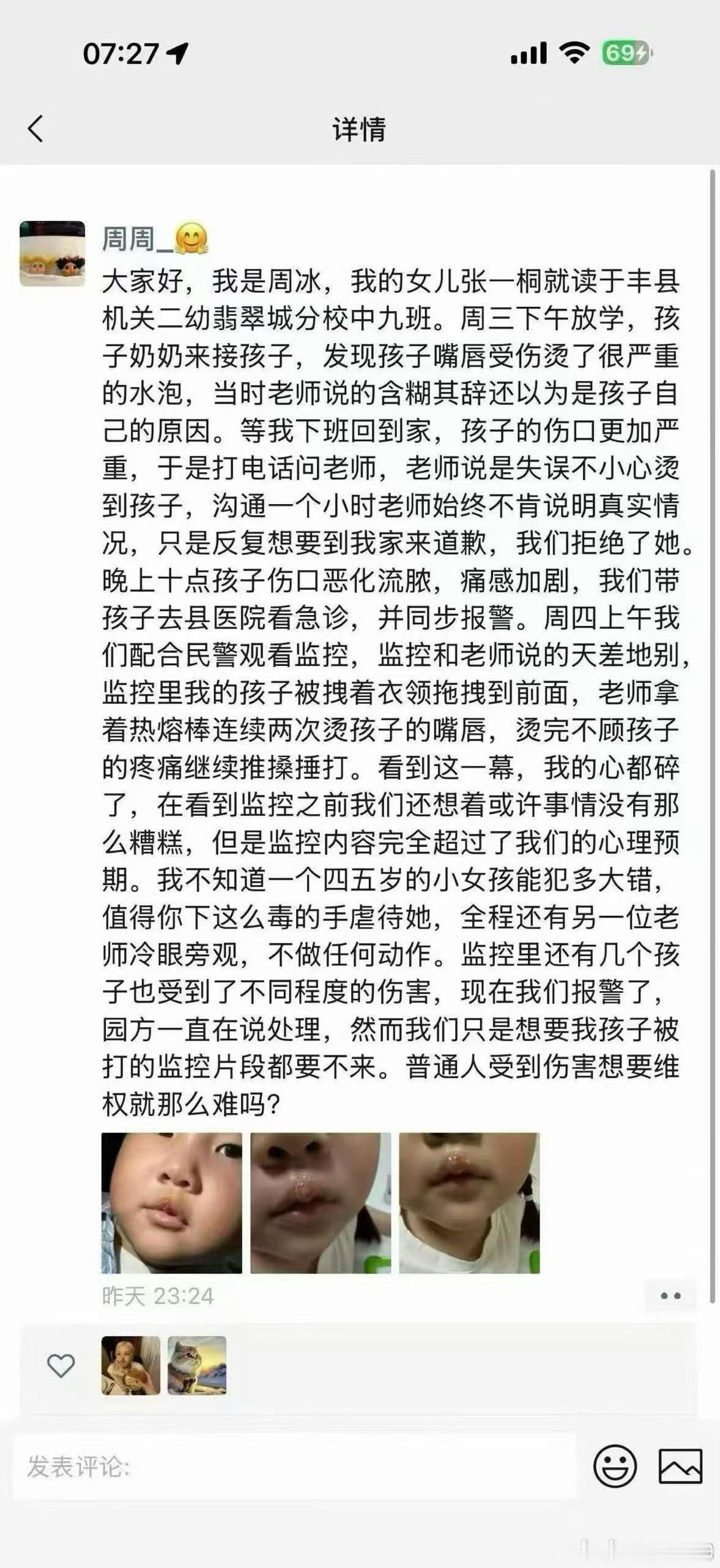 看到这个好气，江苏徐州丰县一幼儿园教师故意用热熔胶枪烫伤多名小朋友嘴唇并施暴，监