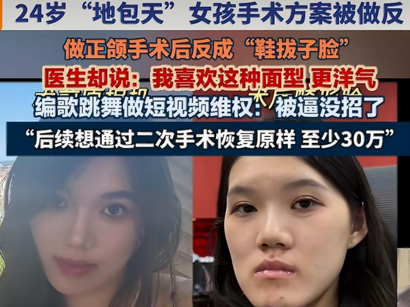 卫健委介入24岁女孩正颌手术被做反“面对女孩维权，主刀医生以个人审美为由推脱，称