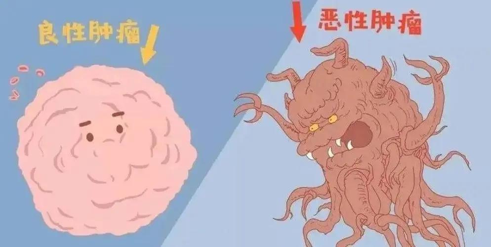 #健康真探社#【听说癌症会遗传？没错，有几种下一代会继承！】生活中常常听到有家庭