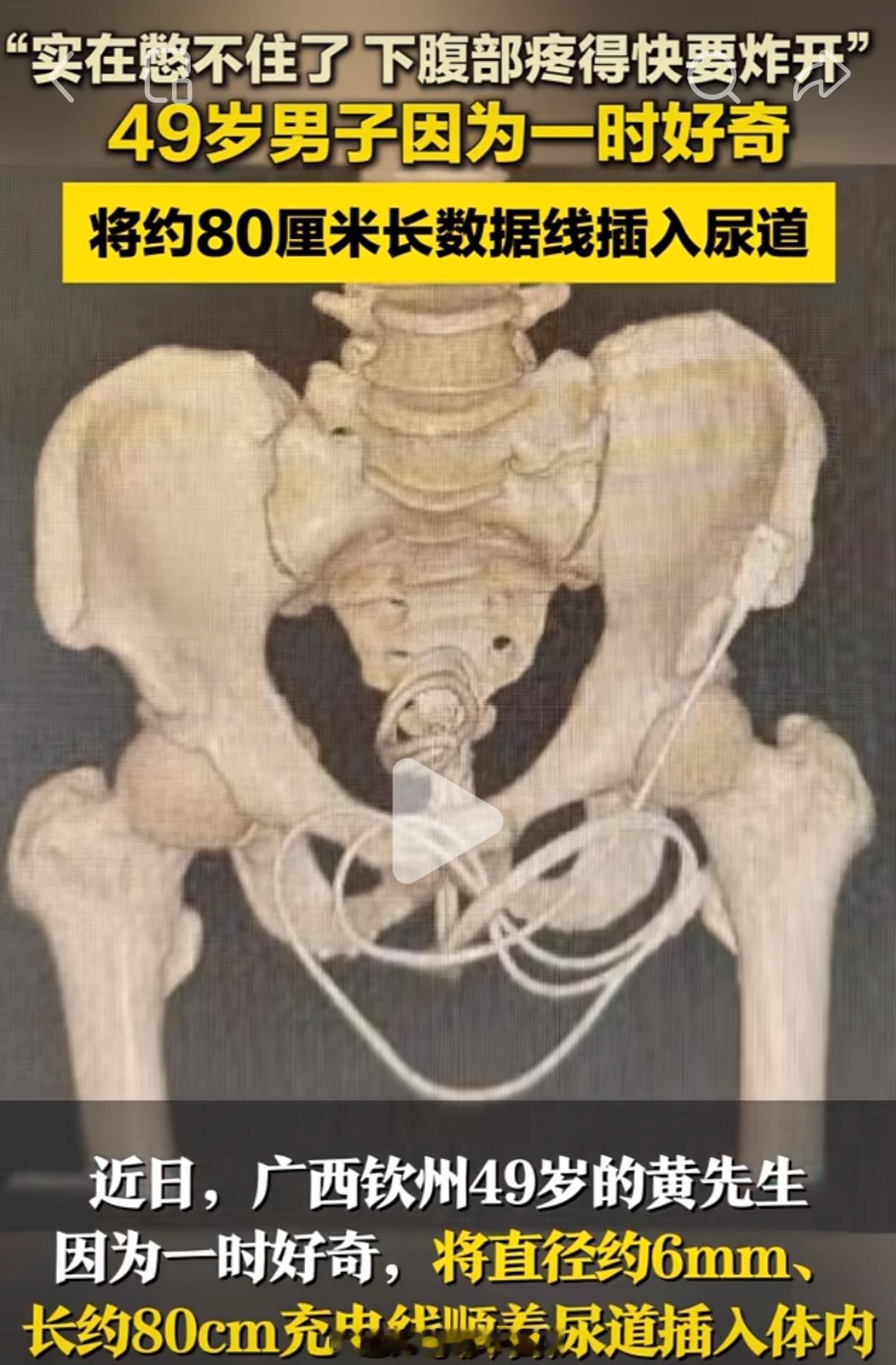 诡计多端的0️⃣，那不是YD！ 