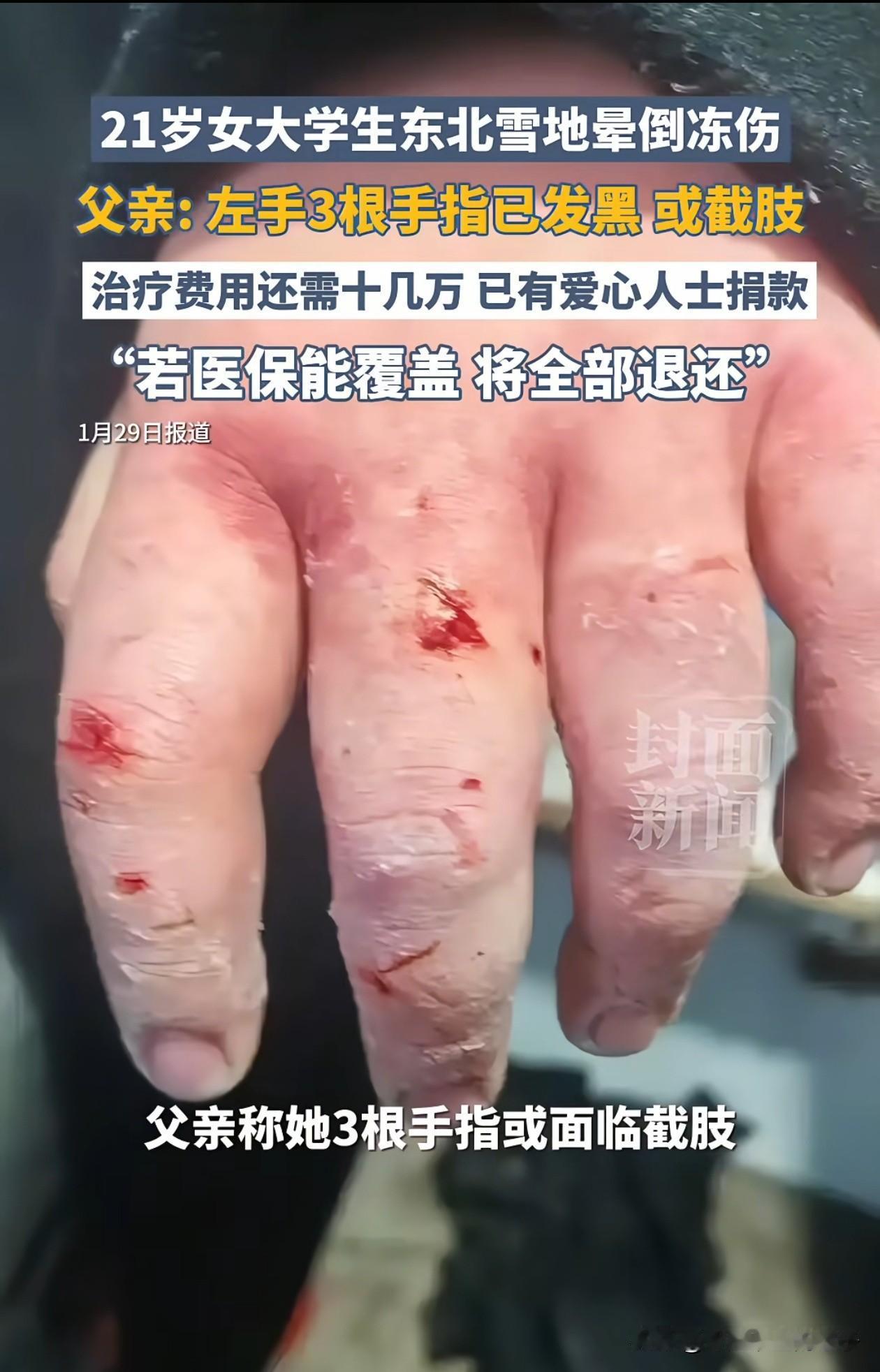 不可思议！四川一女大学生到东北旅游，下车时不小心摔倒在雪地，站起身因找不到眼镜，