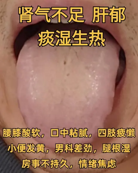 大家早上好，有问题及时发，直接出结果！ 1.肝郁脾虚，湿气大 2.脾肾...