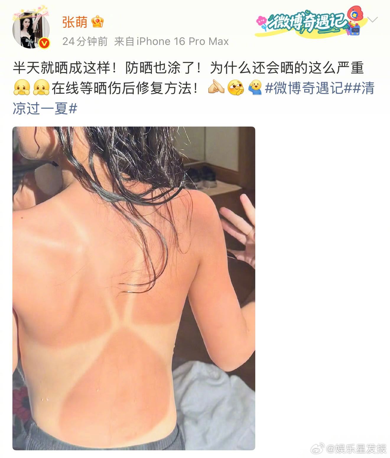 张萌在线求晒伤修复方法 姐这是去哪里玩了！居然晒这么严重，姐在线求助网友修复方法