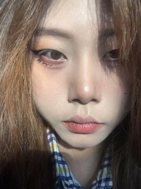 张小熊史颖黄金微针真实体验