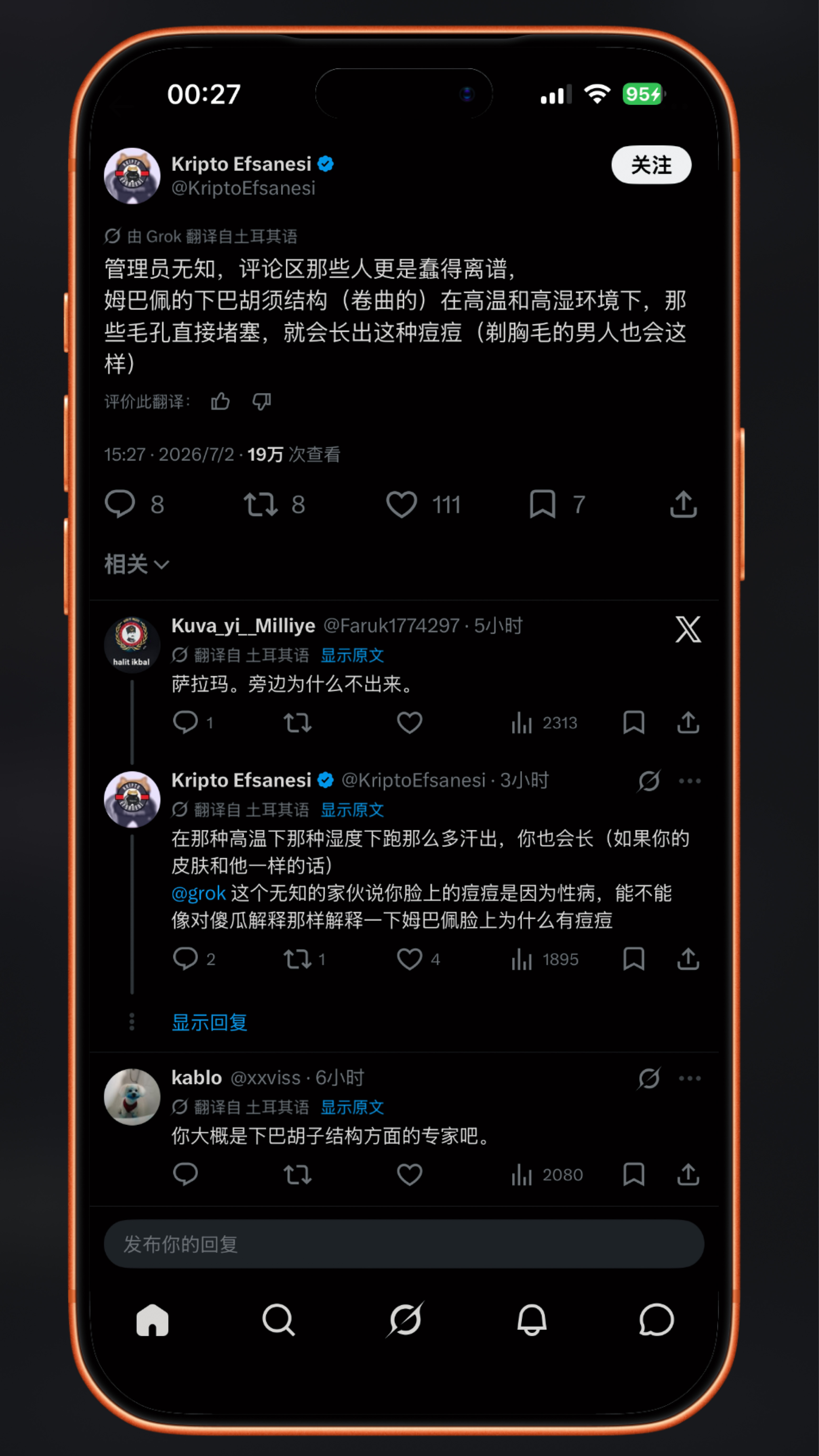 姆巴佩的脸怎么了这个解释还算合理