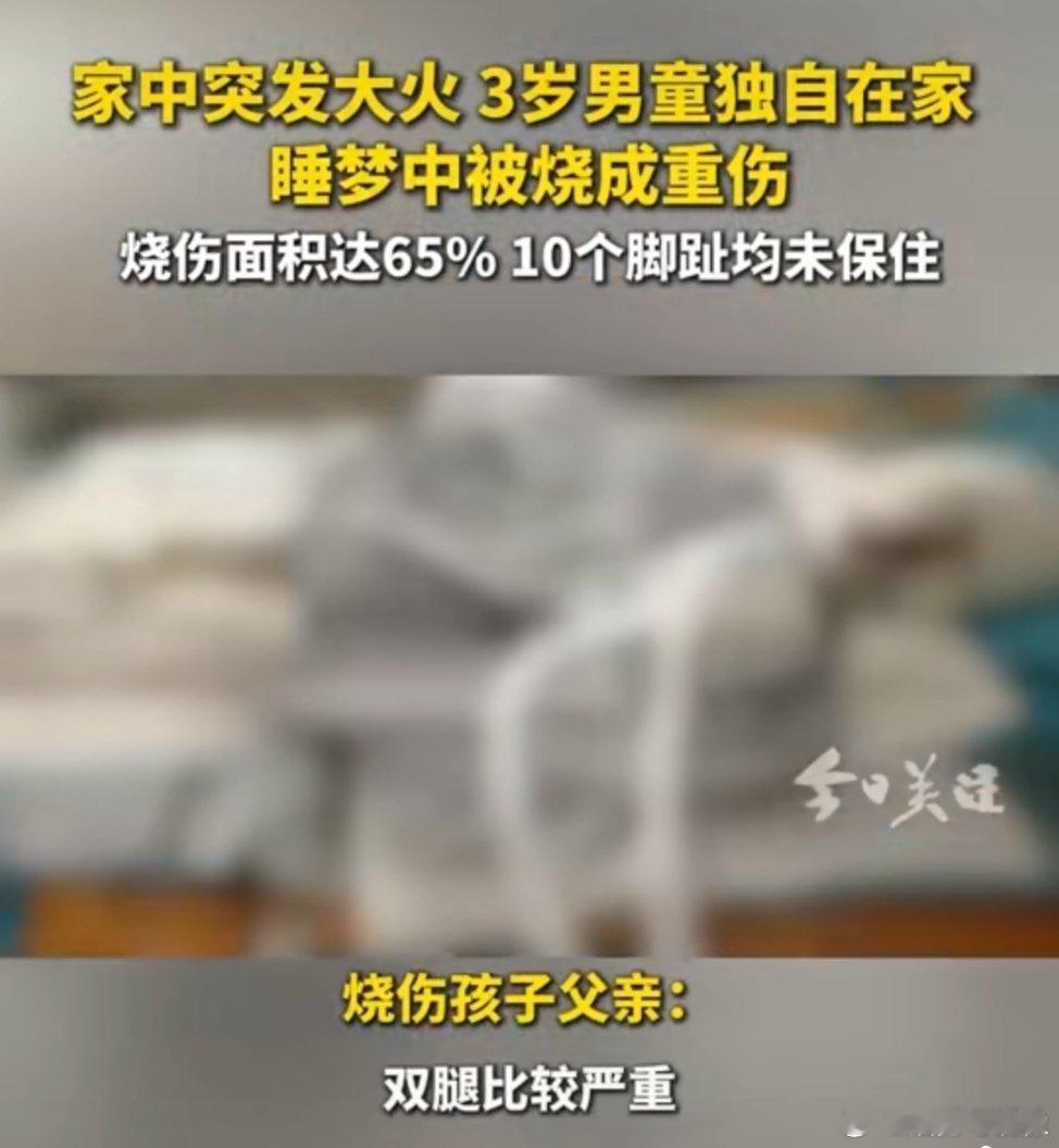 3岁男童独自在家睡梦中被烧成重伤 其实不怪爷爷，爷爷残疾还照顾孩子，而且他不是有