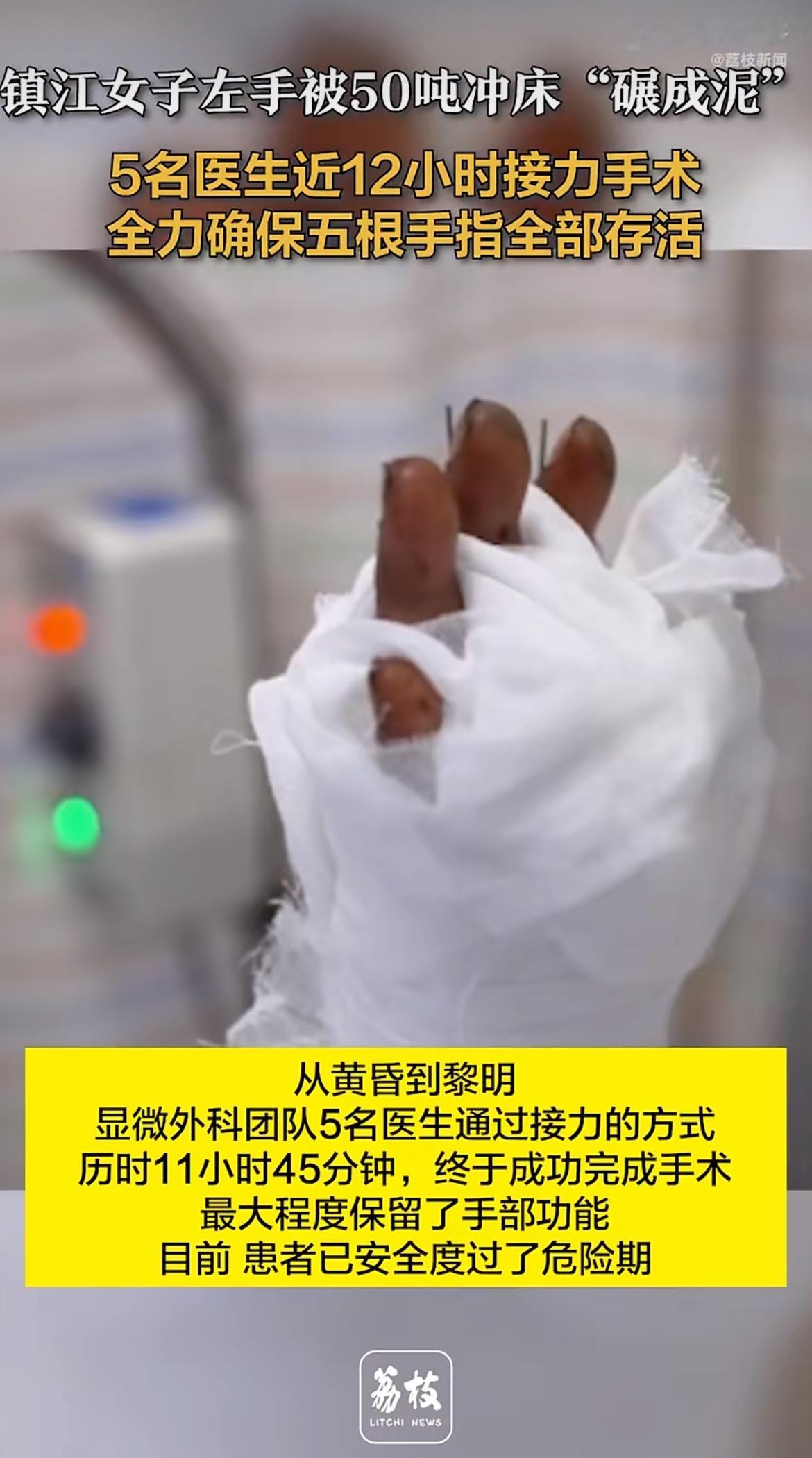 50吨冲床把左手碾成“肉泥”，换做别人估计直接截肢了事，可镇江的医生偏要“逆天改