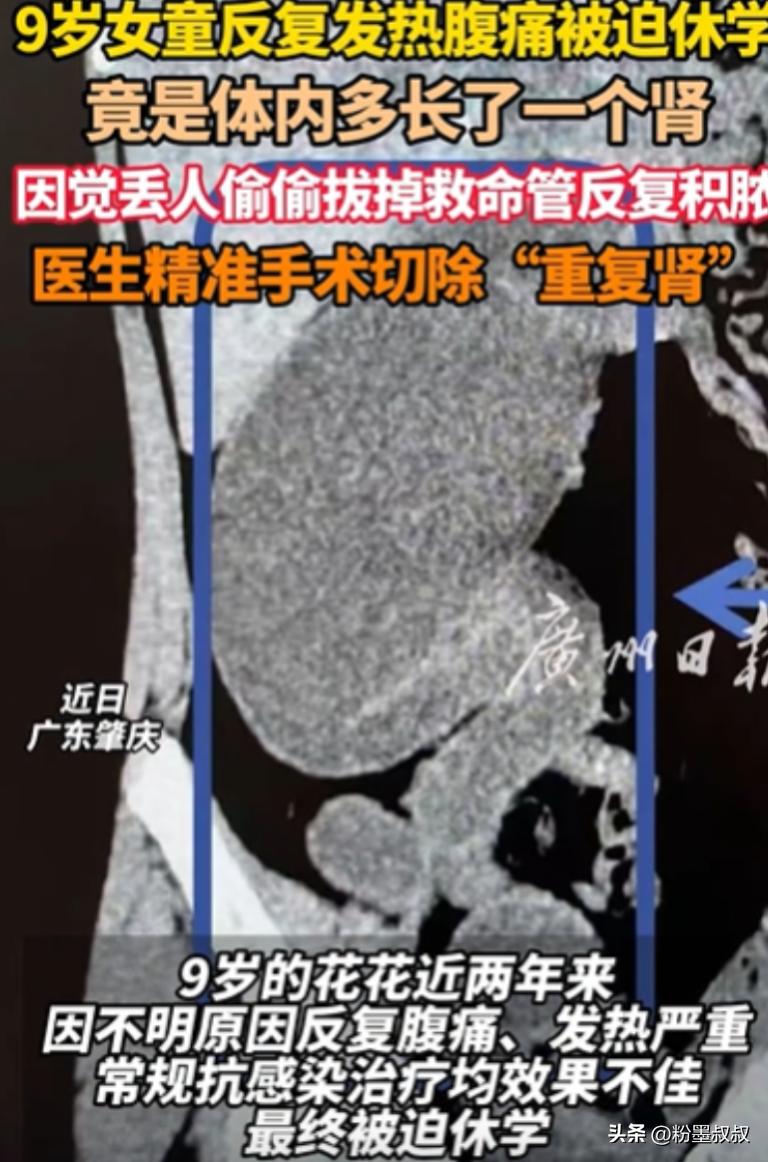 “解释不清了！”广东，9岁女孩反复发热腹痛，被迫休学！去医院检查，竟然发现女孩体