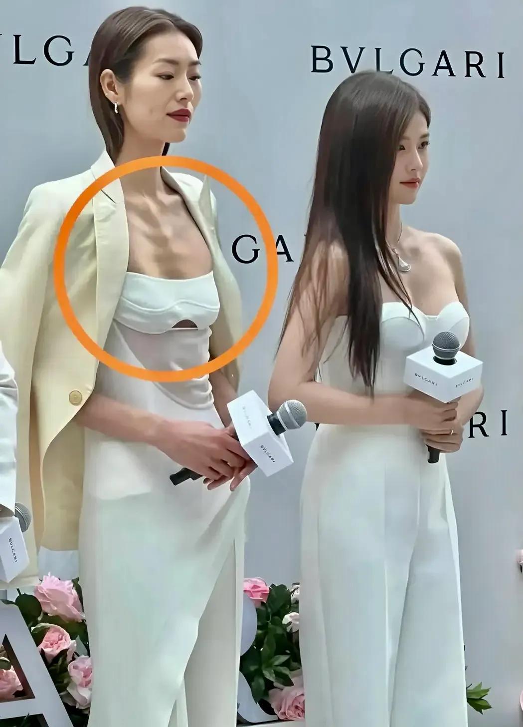 刘雯，名模，身高178cm，体重104斤，瘦骨嶙峋，挺吓人，还是有点肉肉好看，不