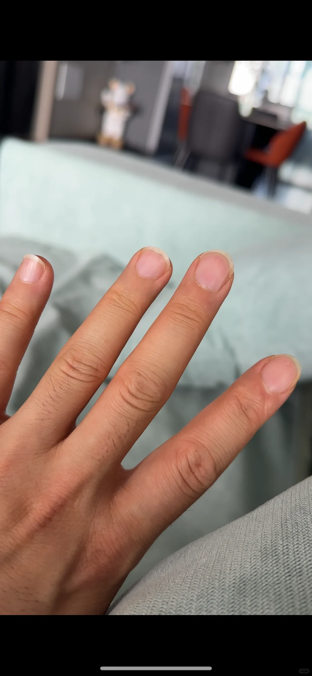 五月到现在 坚持做建构 快4个月了，甲床和形态肉眼看见的变好看了。 终...