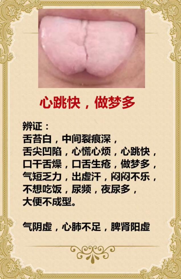 心慌心跳快、多梦睡不好？多半是气阴虚、心肺不足、脾肾阳虚