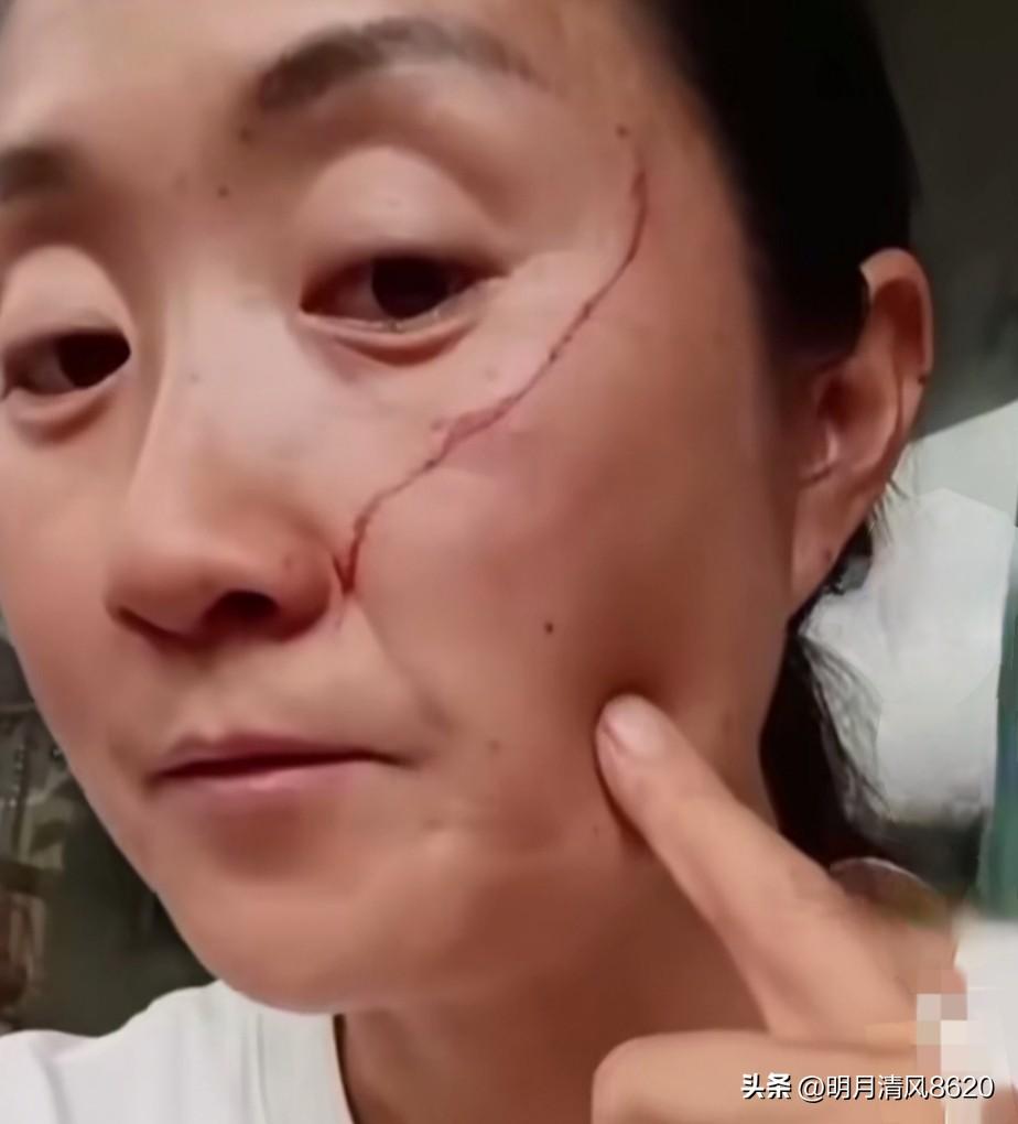 女子晒图被高三女儿殴打

家一个处在青春叛逆期的高三女儿，在家不按时吃饭，整天躲