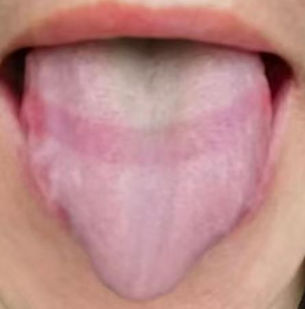 男性精力衰退调理难？气血通畅、瘀堵化开才是关键






很多男同志被海绵体质