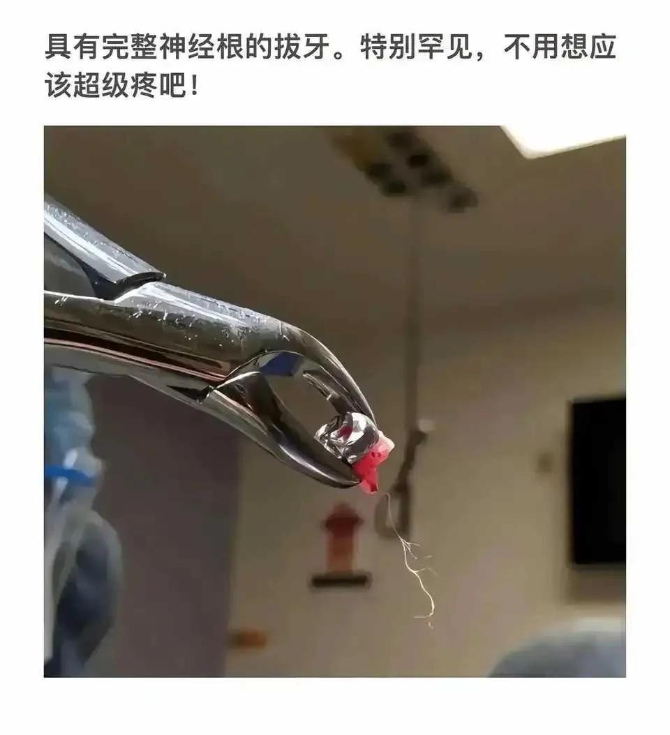 看图片我都牙疼啊就这个照片吧