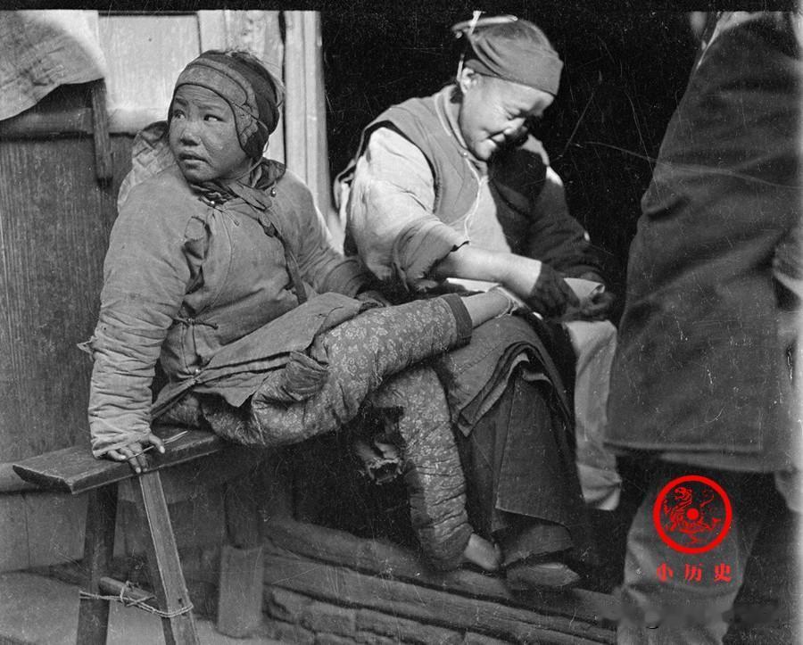 【大清早就亡了，还有父母强迫女儿缠足，真是匪夷所思】1919年，浙江石岭，一个七