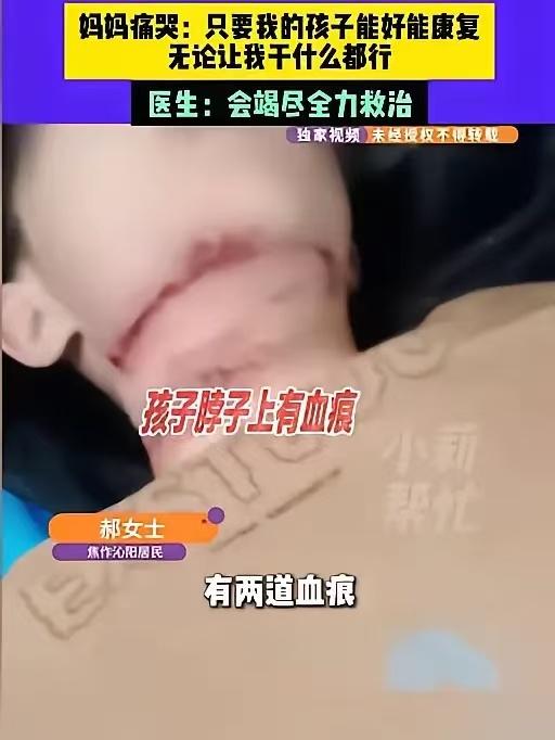 13岁男孩被绳割喉最新进展，成功筹款50万，肇事者首次被曝光！

飞来横祸，触目