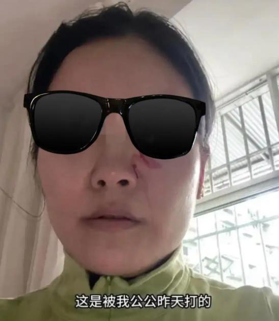 四川徐女士，因为天气太热，穿了一条牛仔短裤，她公公便指责她不检点、不要脸、没有女