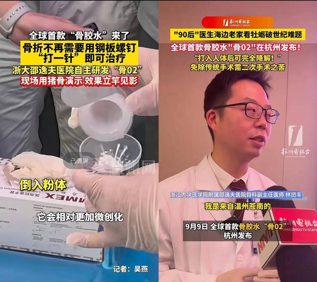 万万没想到，浙江邵逸夫医院研发出了
全球首款骨胶水——“骨02” ，有效解决了骨