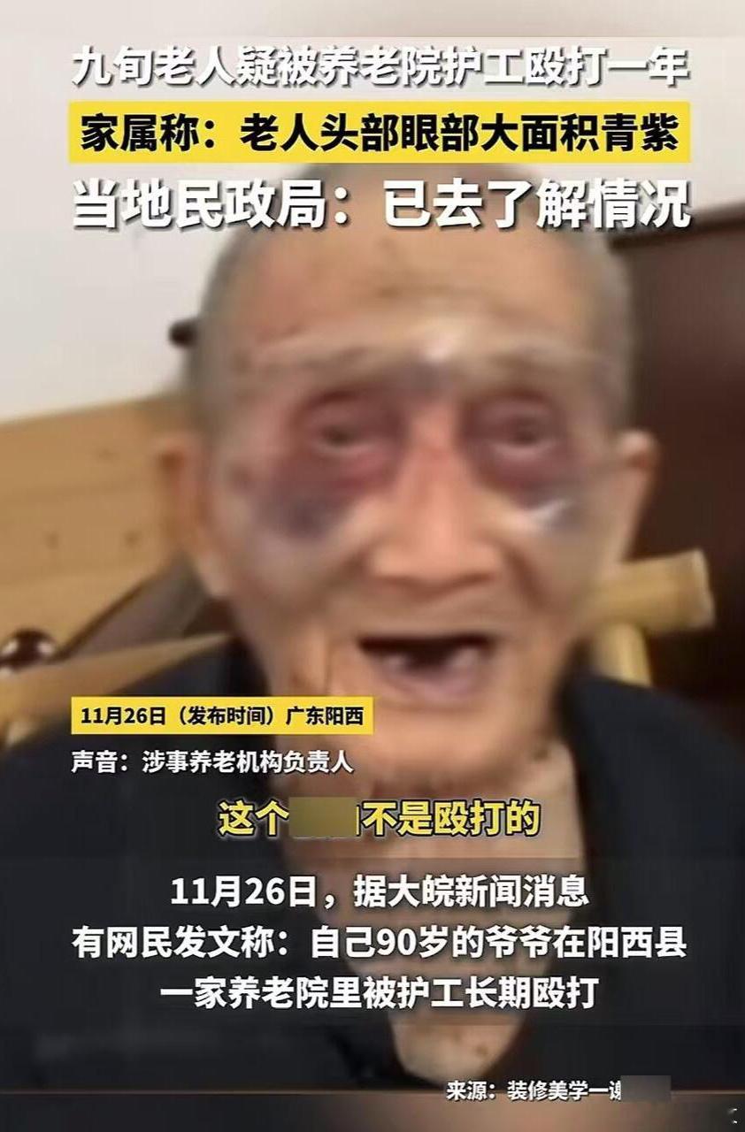 89岁老人养老院被打一年才被发现吗？真是一群孝顺的好孩子[good]  