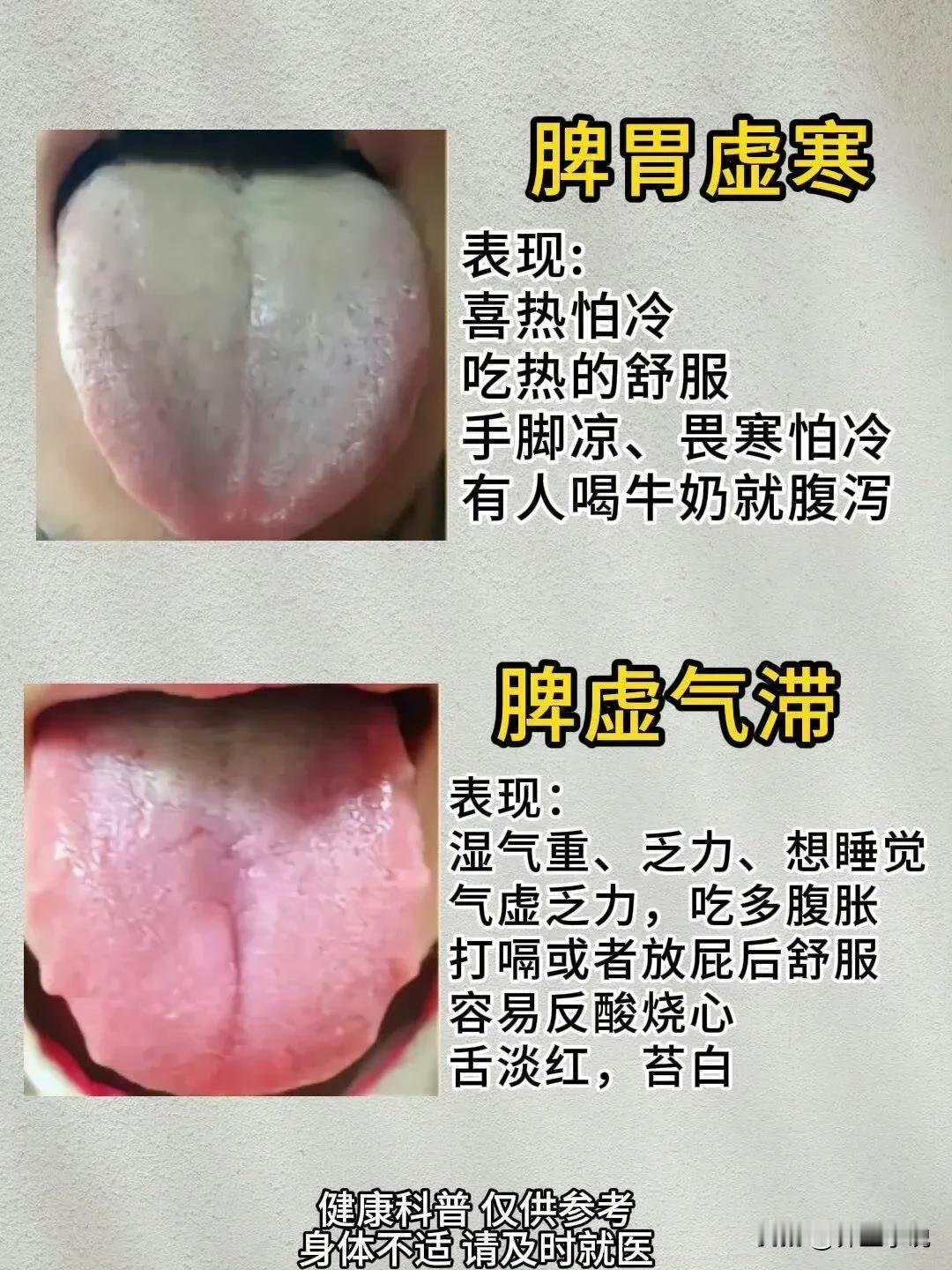 脾胃不好的6种舌苔，看看自己是哪一种？ ​ ​​​中医看舌苔能看出什么呢?