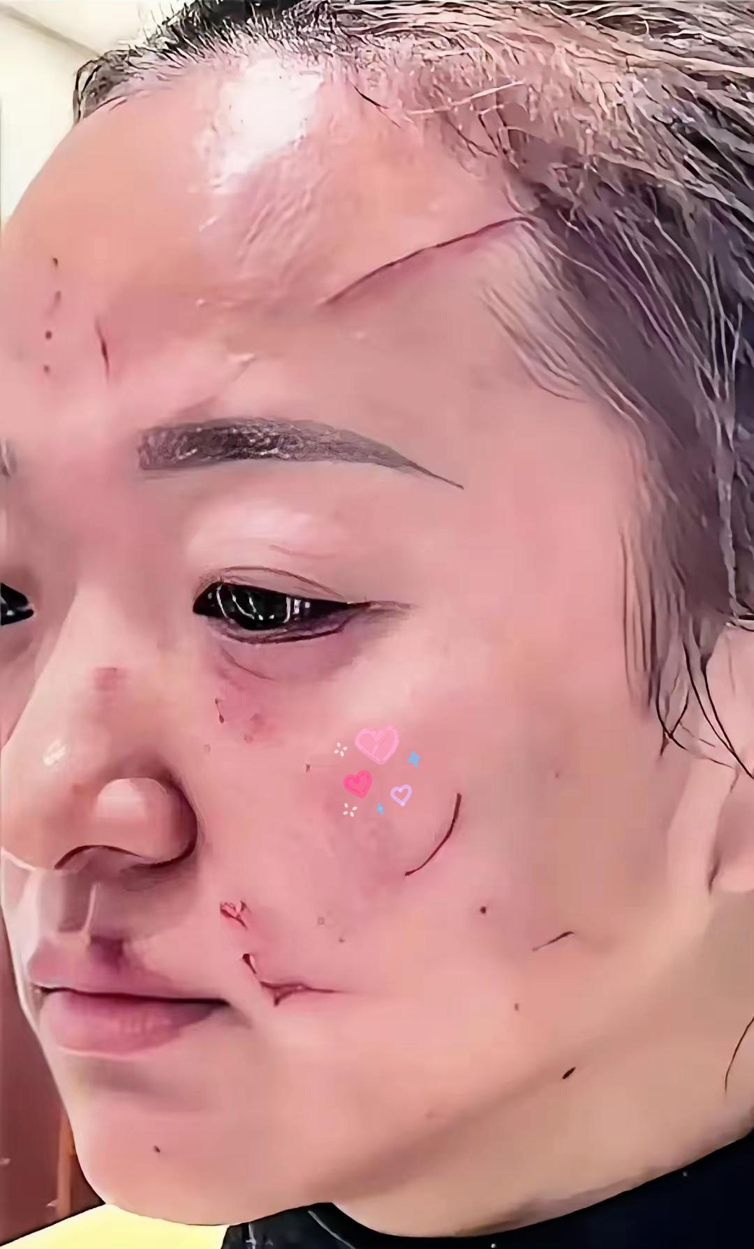 救不了的“痴情”：女儿被家暴7年，我接她回家竟偷偷跑回去！
 
       刷