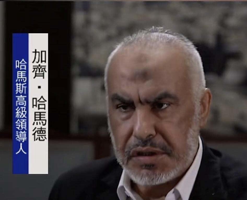 印堂发黑的标本。
要么是生活习惯出了问题，要么是生存空间出了问题。