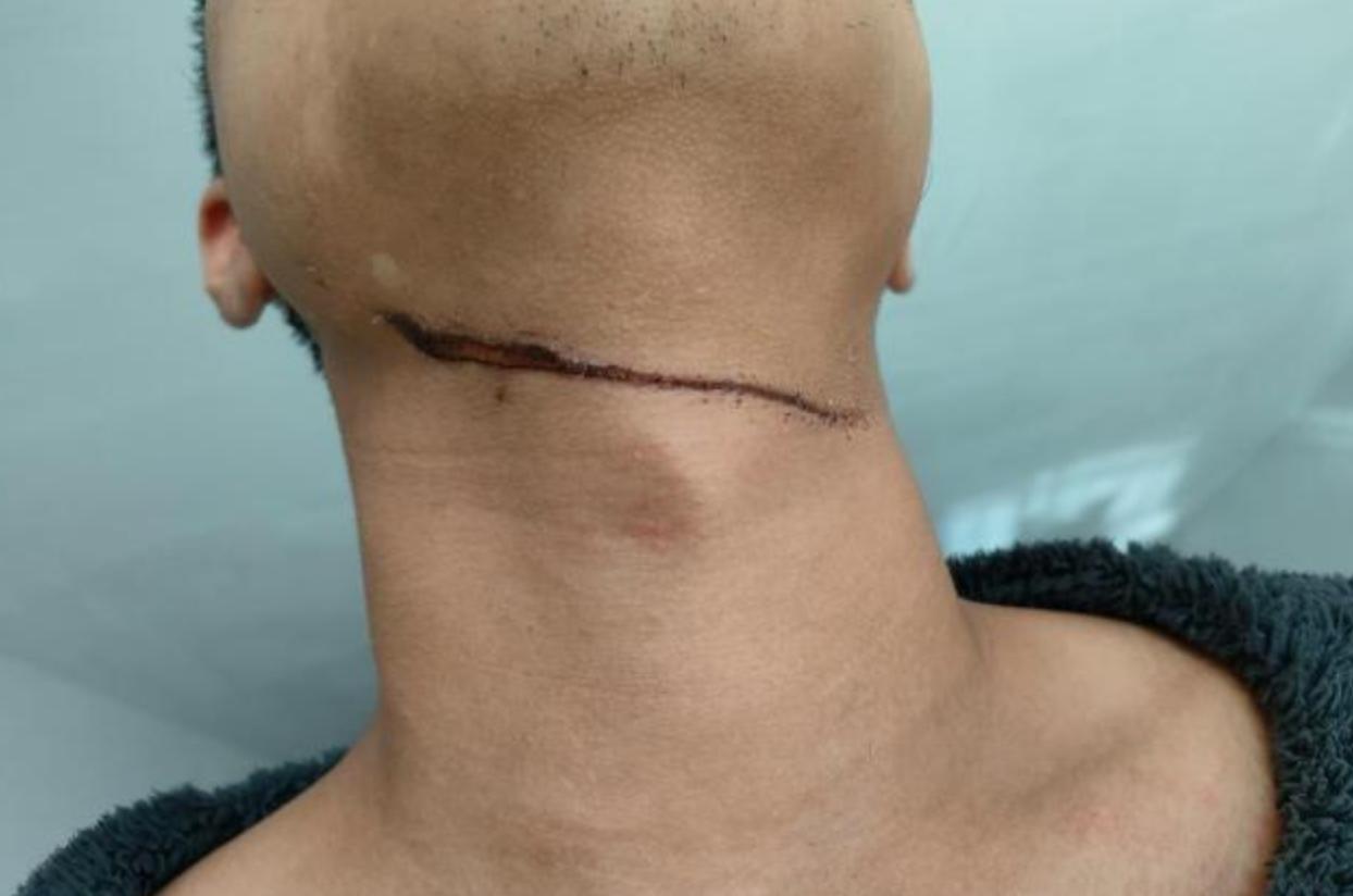 近日，来自山东的刘女士找媒体求助：她和20岁的儿子小丁租住在山东省德州市云县水岸