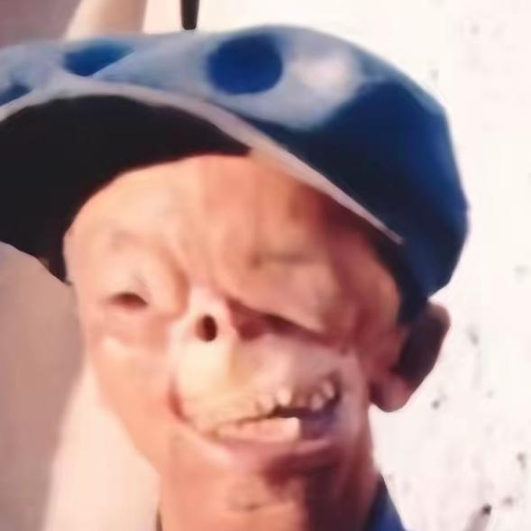 3岁被狼咬掉半张脸，父亲嫌他是累赘，半夜把他扔进了狼洞。你猜怎么着？这个被亲生父