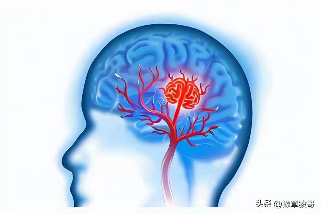 听说“洗澡也可能洗出脑梗”，你是不是也像我一样，差点把手里的搓澡巾扔出去？
洗澡