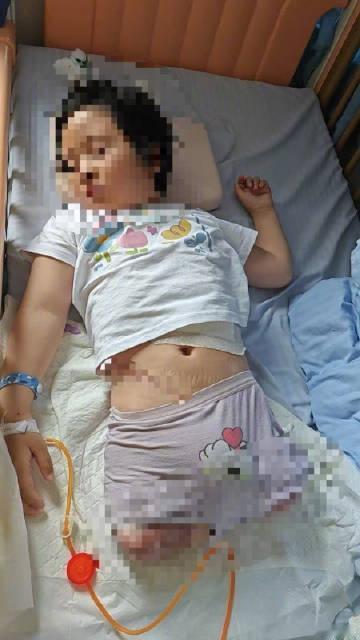【7岁女童被货车碾压截肢父亲发声：女儿已返校上课，未来康复治疗过程漫长，需要全天