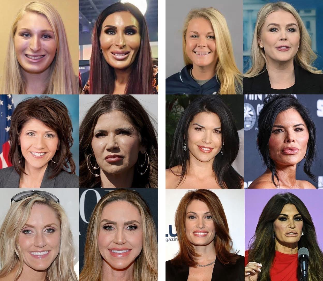 美国富婆都喜欢这样美容。