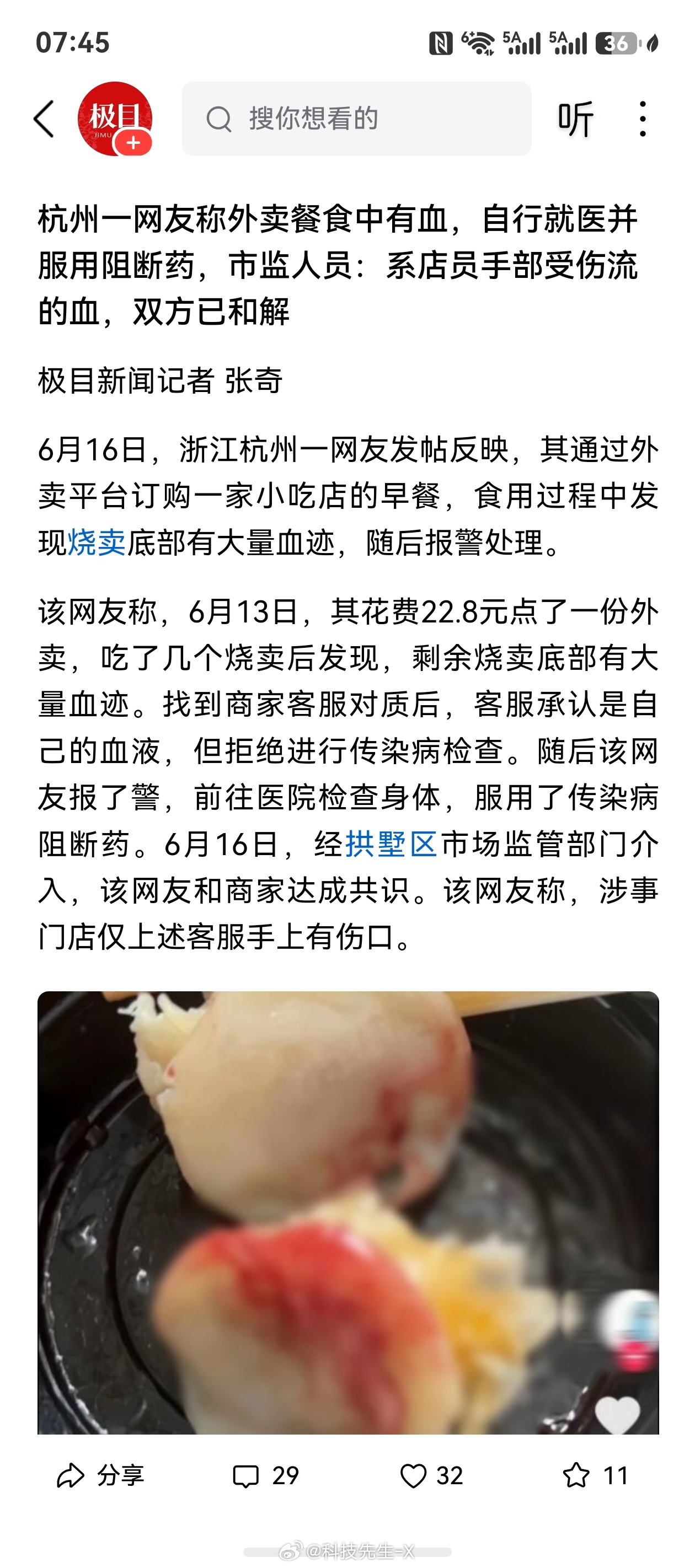 这个外卖店员手部流血的话，应该换新食品才对 杭州一网友称外卖餐食中有血，自行就医