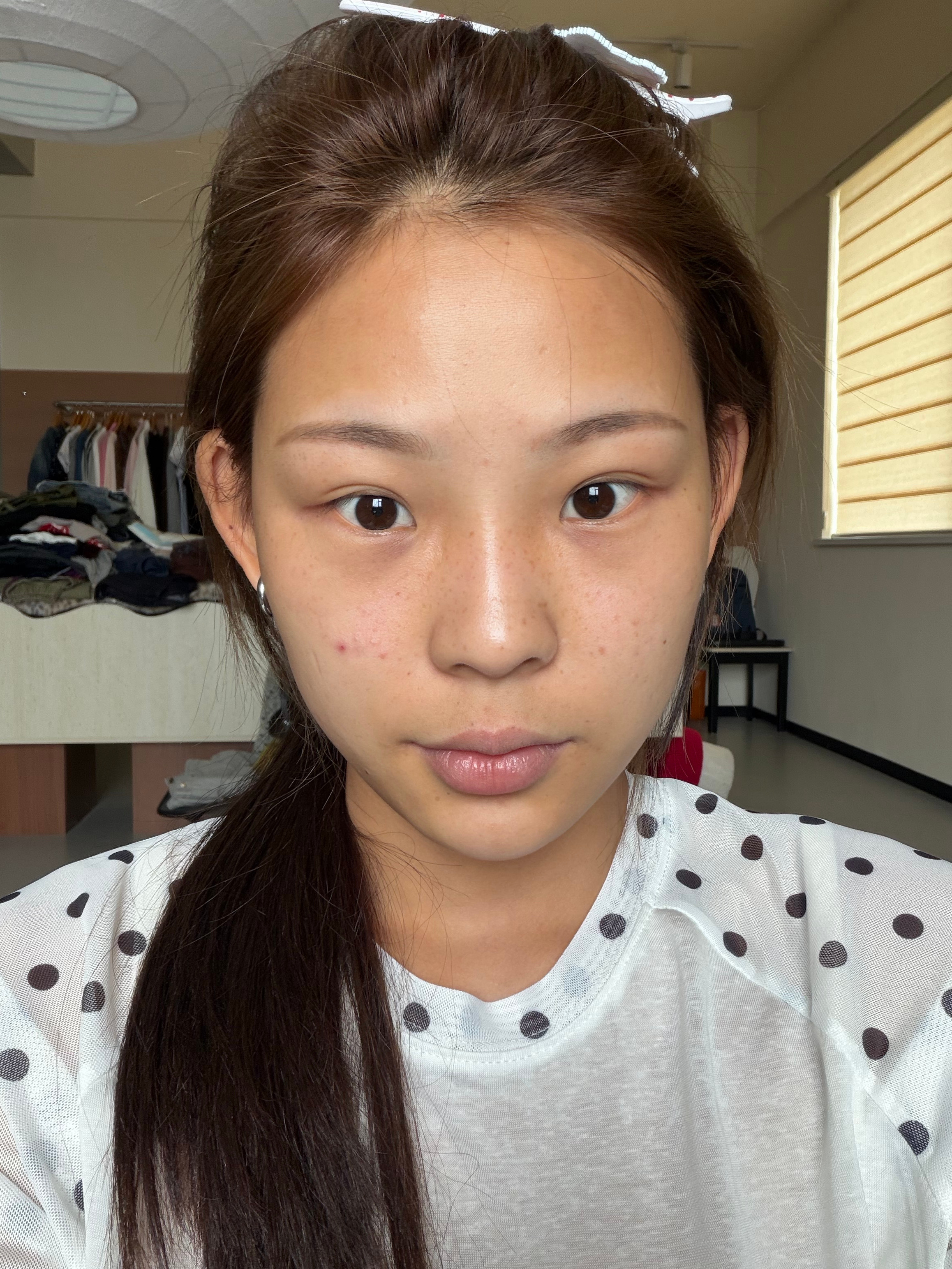 很容易被看不起的人就是我们这种减肥人家宝说我打针馒化了吗我：那他妈是胖的……. 