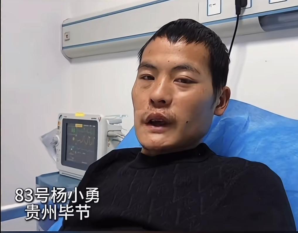 再过1天就有2000元，

刀疤哥却退赛了，

退赛原因让人唏嘘，不是因为他想退