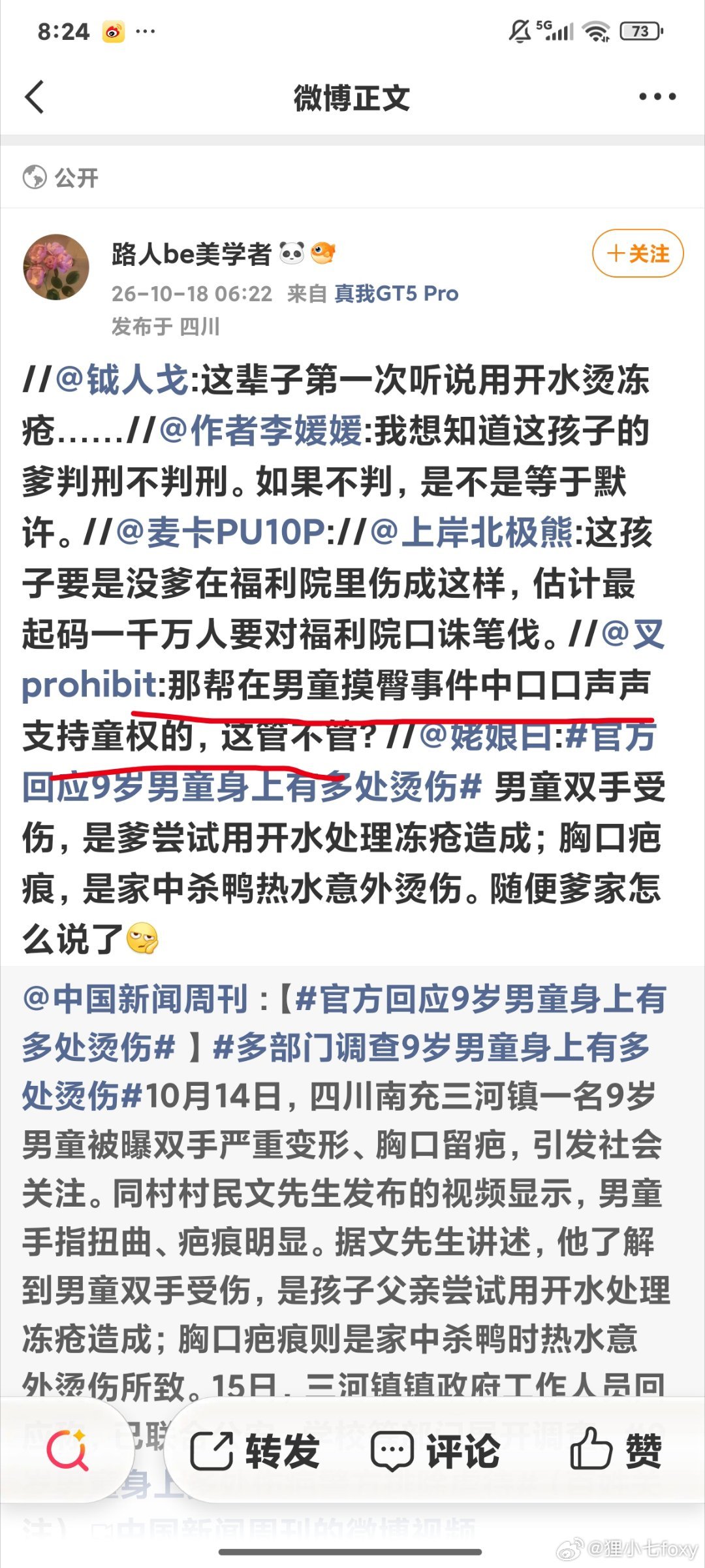 官方回应9岁男童身上有多处烫伤这个事件没有人异议啊，都在支持维护儿童权益，谴责这