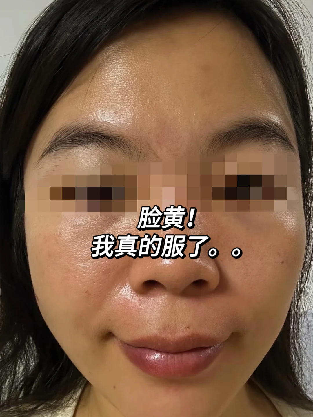 黑黄皮，我真的服了…