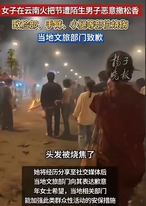 天啊，这么丧心病狂的吗？
一女孩去云南体验“火把节”，结果头发被烧焦，小腿&胳膊