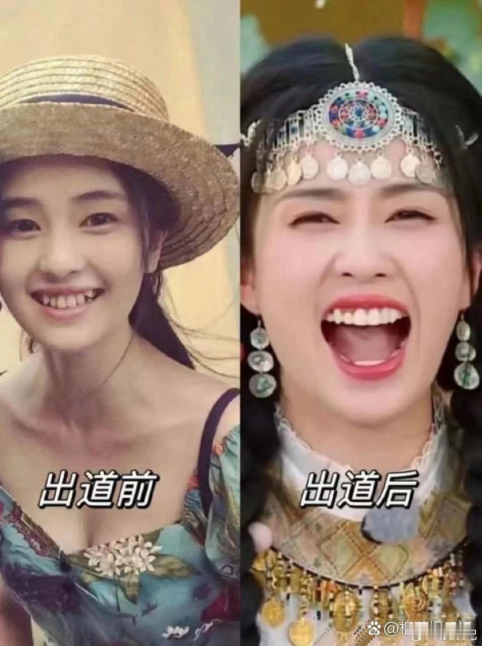 白鹿整牙就像换脸一样 ​​​