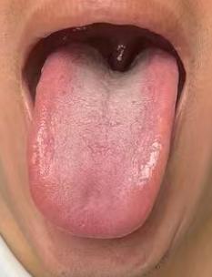 固摄能力不佳？根源和局部状态息息相关






很多朋友坚持戒色很长时间但是功