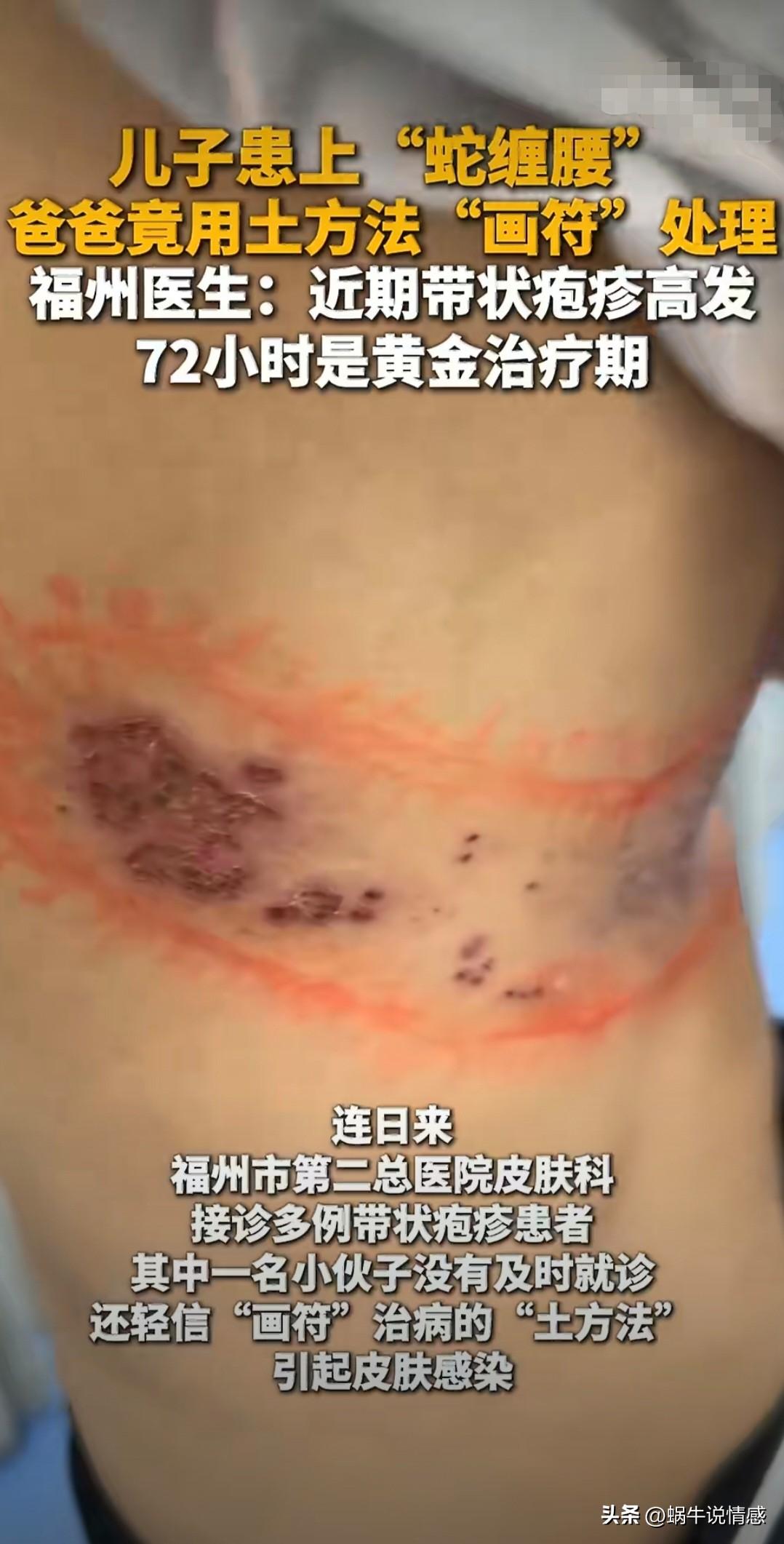 封建迷信要不得，尤其是在孩子生病的时候！家长还是有点医学常识比较好！

23岁的