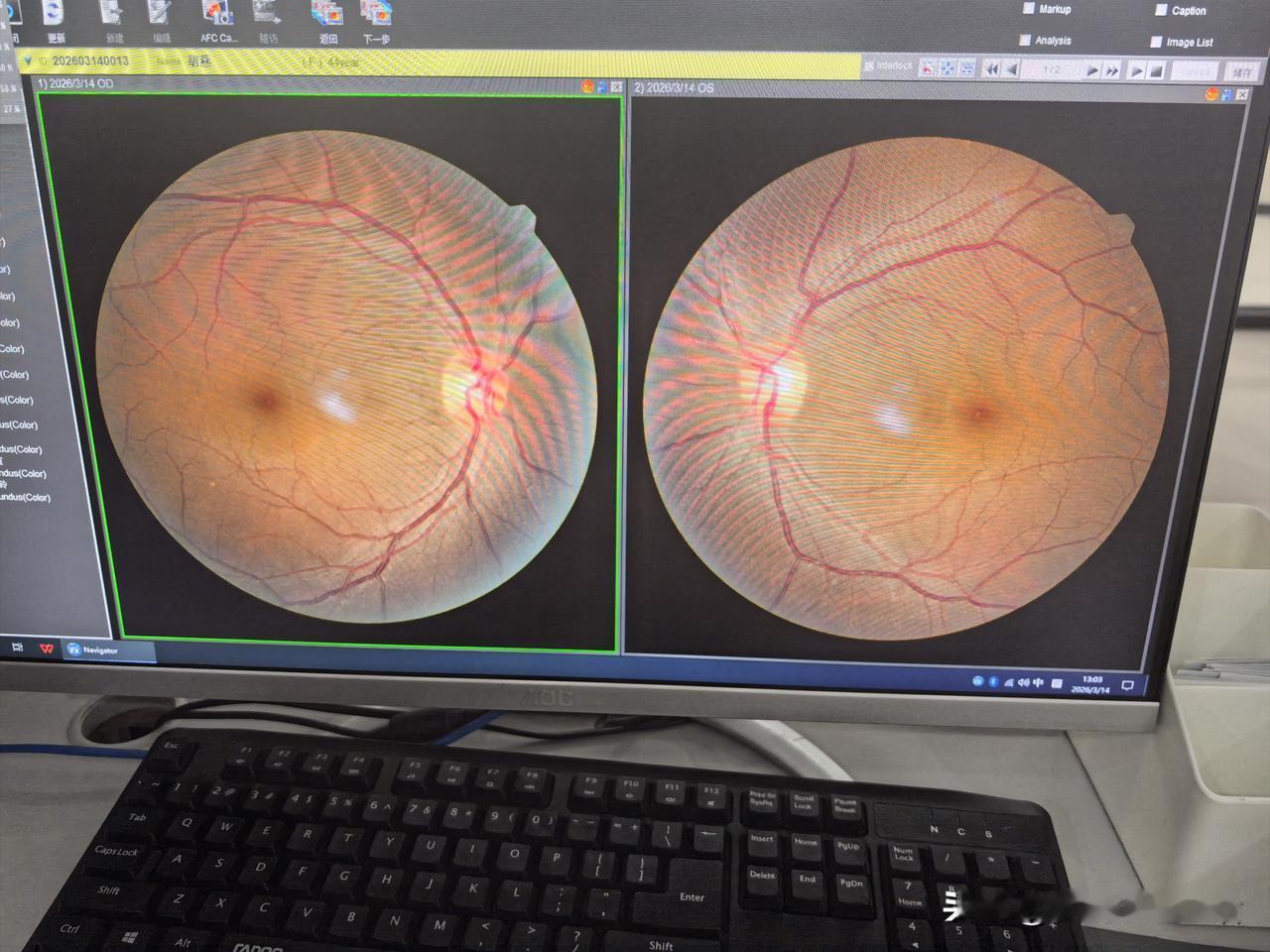 给大家看一张图片，看有没有人认识这是啥？我问过身边的人，有说是月亮、有说是有公的