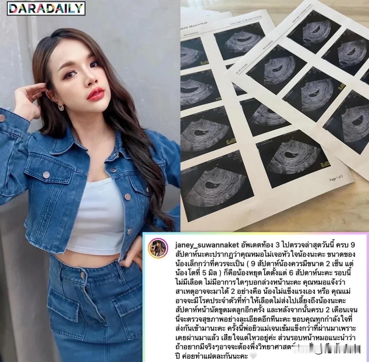 #泰国娱乐# 【Janey怀孕二胎再度失败】Janey的二胎之路真的是命运多舛啊