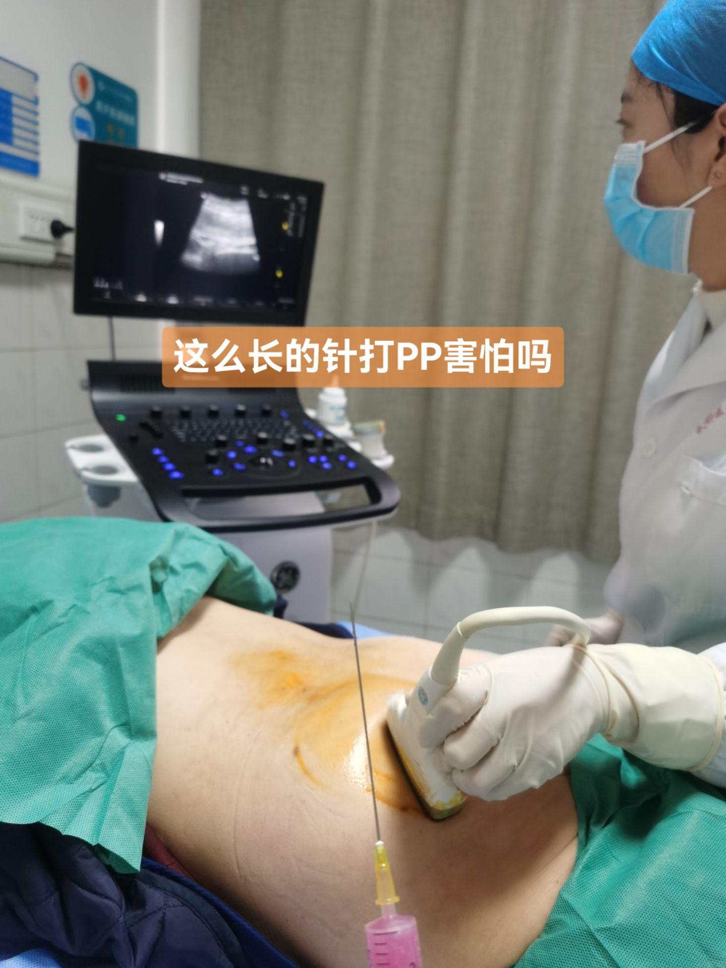 超声可视化坐骨神经阻滞治疗