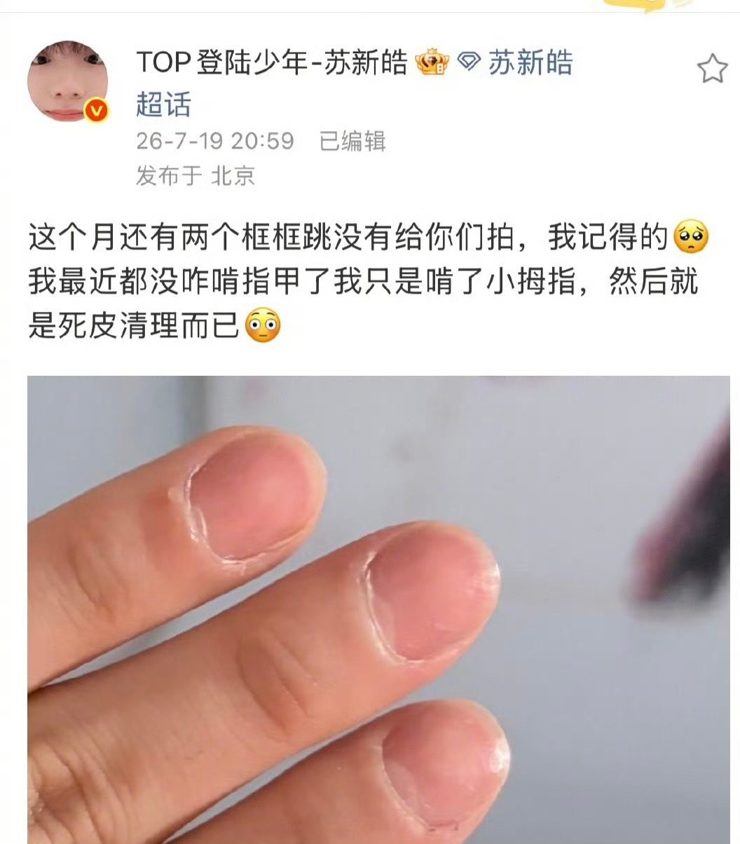 苏新皓你留下指甲哈哈哈哈哈哈老师：苏新皓你留下指甲 