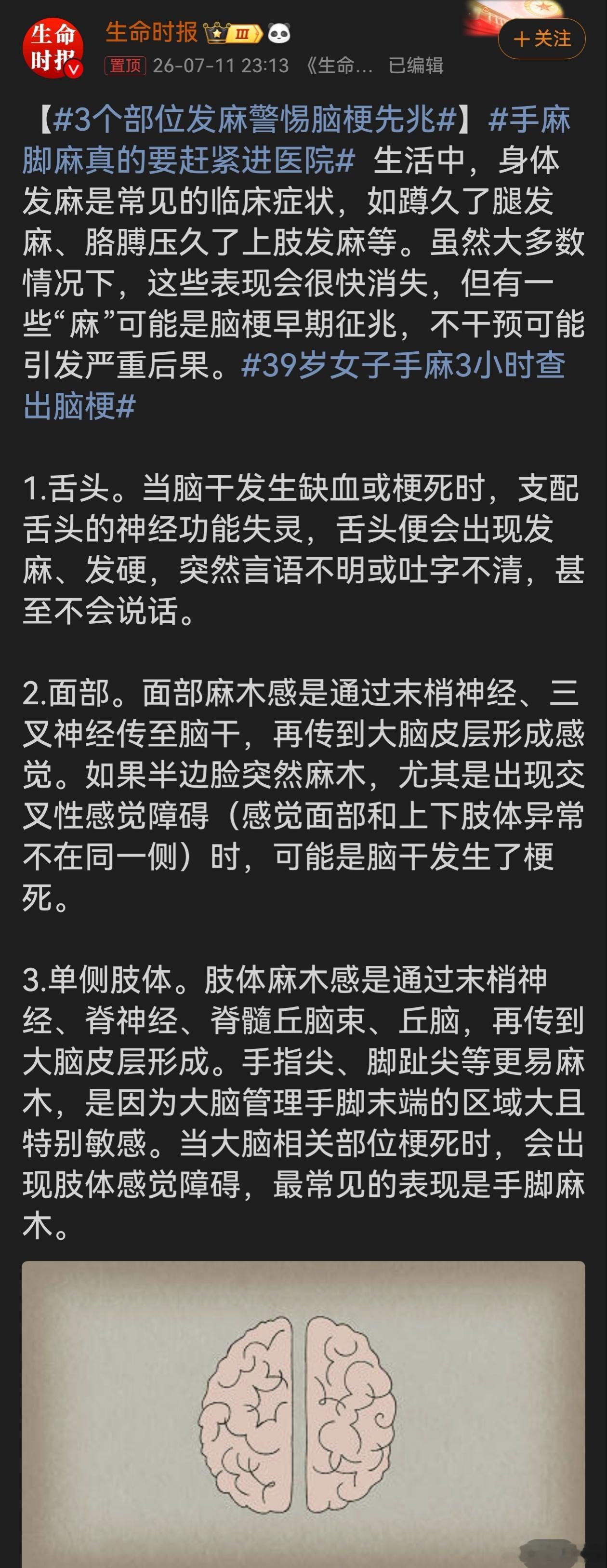 3个部位发麻警惕脑梗先兆很多人遇到手脚发麻只当是压到、累到了，看完这条科普才知道