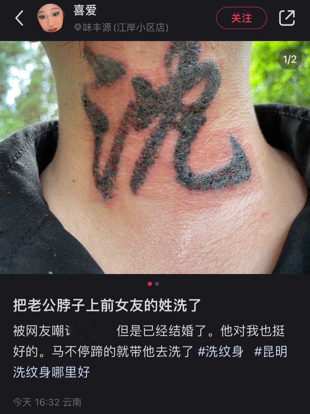 omg纹在脖子上不痛吗 ​​​