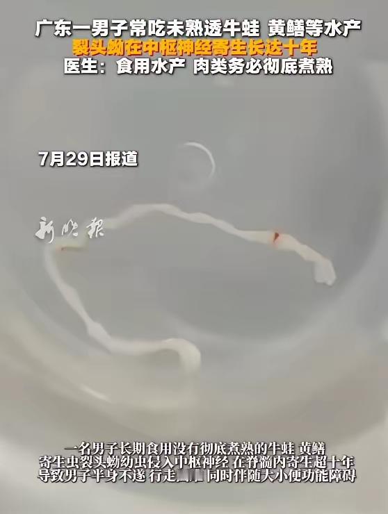 7月29日报道，广东，一男子经常吃没熟透的牛蛙和黄鳝，觉得口感非常鲜嫩，结果寄生