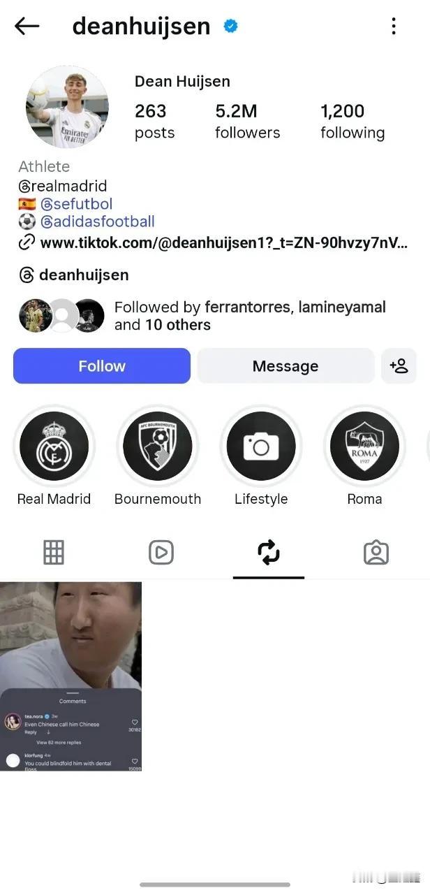 赫伊森“辱华”风波：520万粉账号的一键转发，藏着多少傲慢？

“用牙线就能蒙住