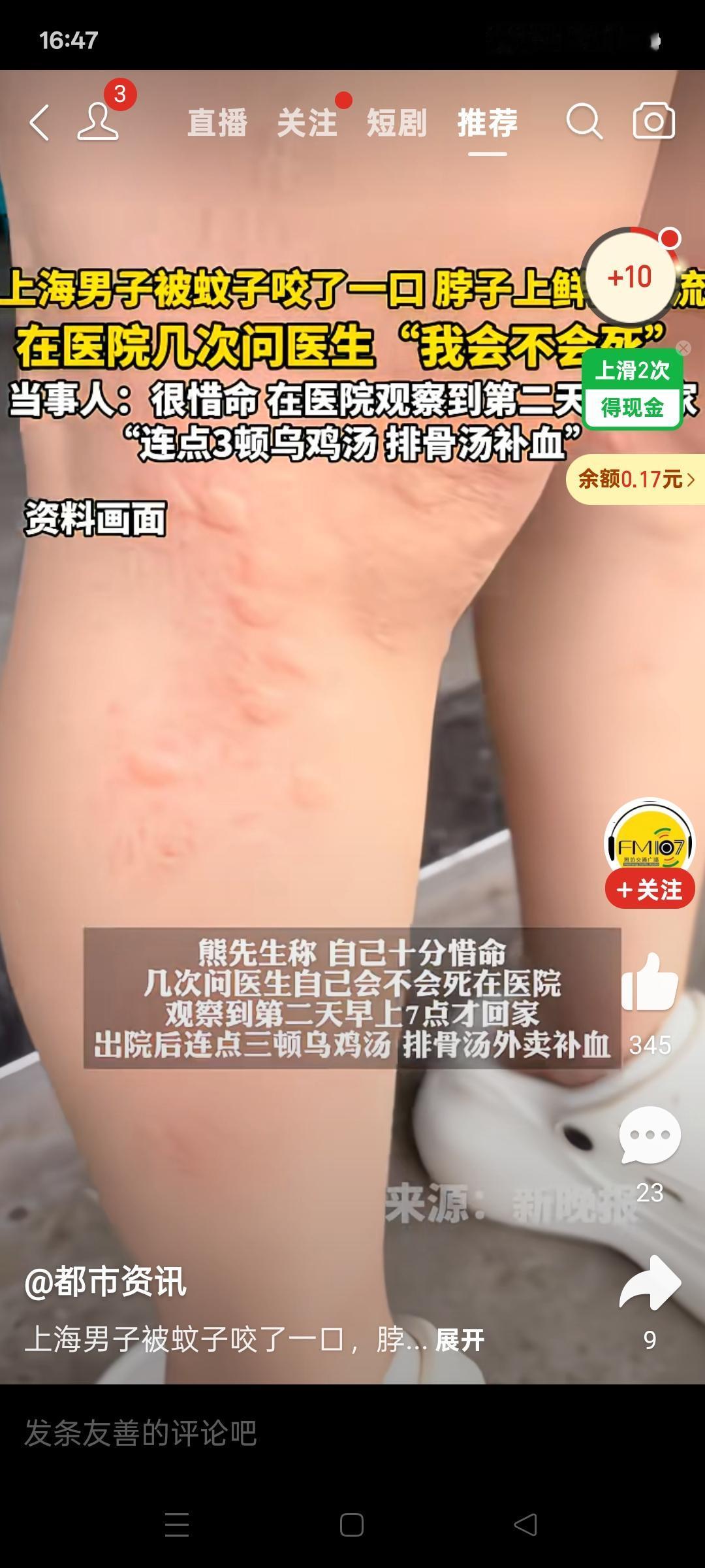 晒图笔记大赛上海男子被蚊子咬了一口，脖子鲜血直流，在医院几次问医生，我会不会死。