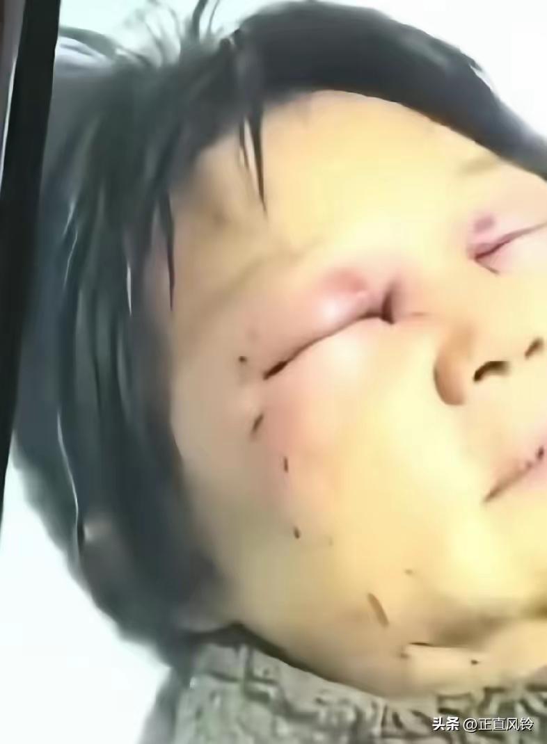 看到儿媳妇打断婆婆肋骨，天菩萨，两个儿子的瑟瑟发抖，二个儿子8根肋骨，以后该怎么